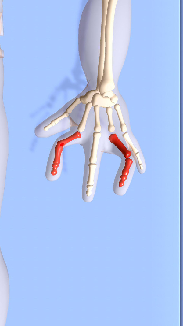 正骨老中医 正骨老中医